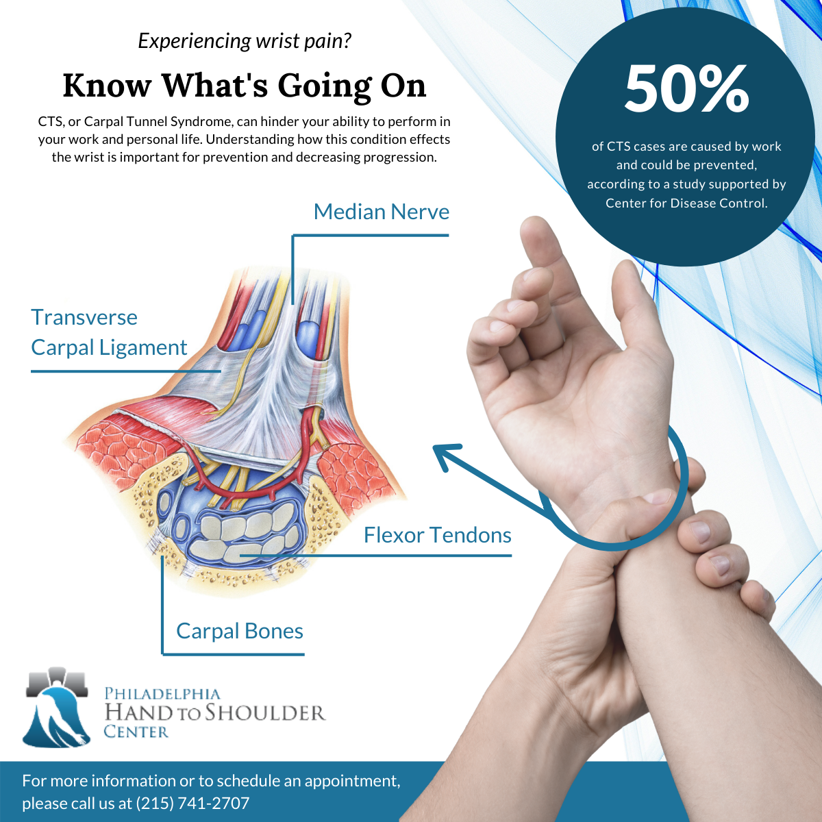 What Is Carpal Tunnel Syndrome? - Philadelphia Hand to Shoulder Center