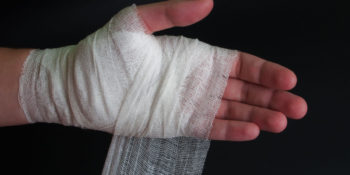 The Most Common Hand Injuries & How to Avoid Them