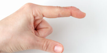 Do You Have a Mallet Finger? Here’s How to Know