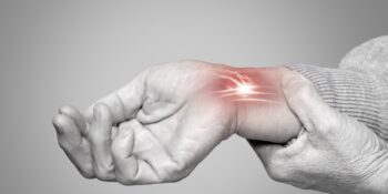 Carpal Tunnel Syndrome vs. Cervical Radiculopathy