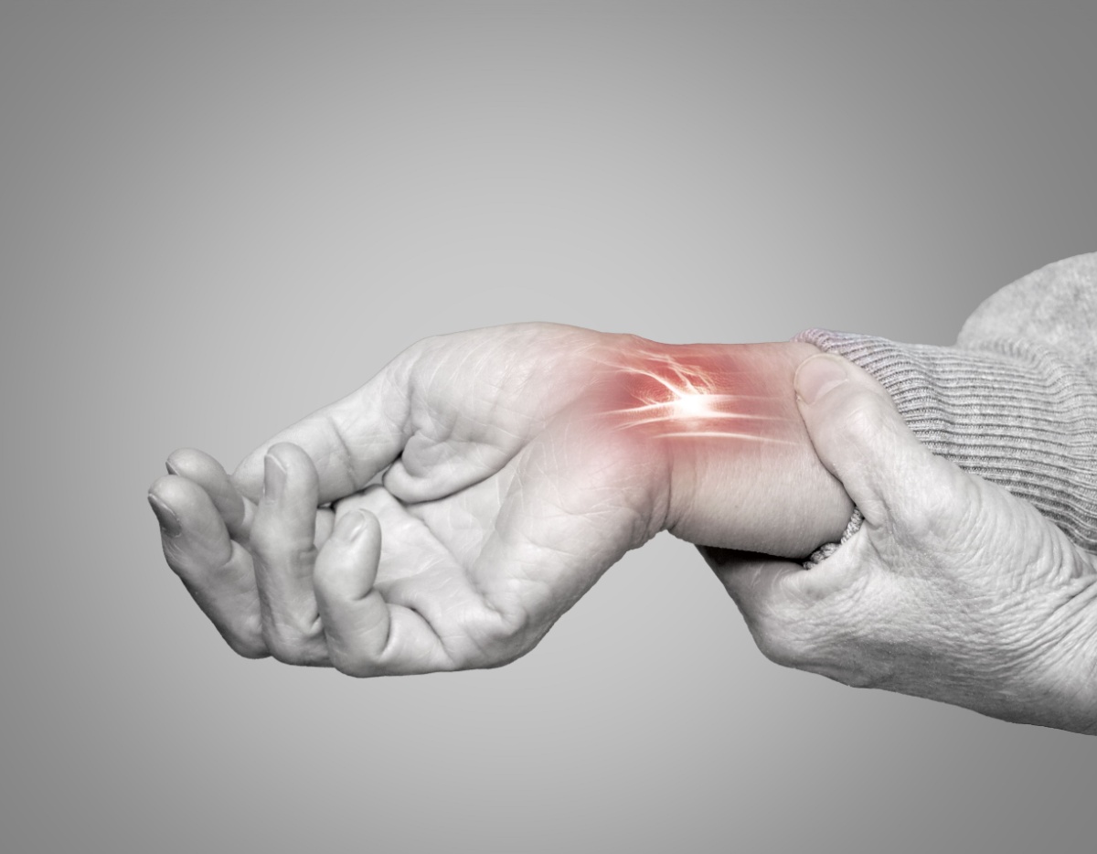 pain radiating from the nerves in the wrist - nerves are highlighted red while the rest of the hand is in black and white