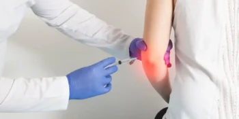 PRP vs. Cortisone for Tennis Elbow: Which Works Better?